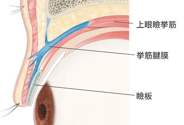 宮益坂クリニックの腱膜性眼瞼下垂症の解説