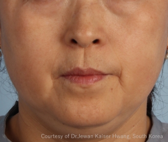 症例写真（治療前）