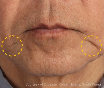 症例写真（治療前）