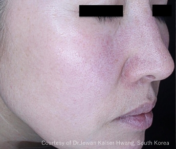 症例写真（治療前）